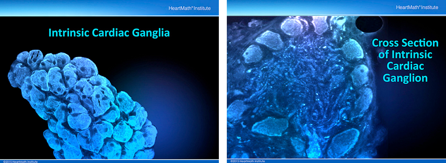 Visualization of the HeartMath Institute "The little brain in your heart" On the Left: This is a highly magnified view of a cardiac intrinsic ganglia taken with a confocal microscope which is able to take images layer by layer and then build a 3D image. Ganglia are made up of groups of nerve cells (somata) that exist outside of the brain and spinal cord. Each of the smaller circular structures shown is the cell body of an individual neuron. On the Right: This image represents a cross section through an intrinsic cardiac ganglion. In the center there is a mass of dendrites which interconnect individual neurons. This is the ideal structure for an independent neural processing unit. 