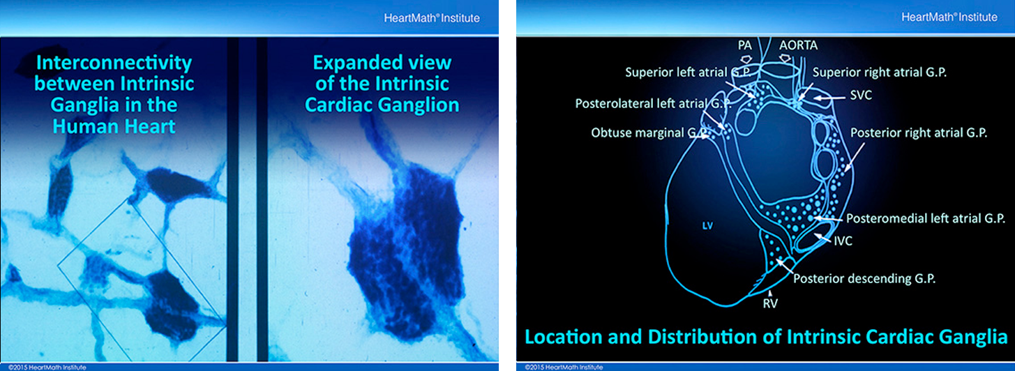 Visualisation of the HeartMath Institute "The little brain in your heart" On the left: This is a microscopic picture showing the interconnectivity between cardiac ganglia in the human heart. The light blue thin structures in the image on the left are multiple axons coursing between and connecting the ganglia. The image on the right is an expanded view of the ganglia shown in the rectangular box in the image on the left. On the right: This drawing shows the location and distribution of intrinsic cardiac ganglia. Note how they are distributed particularly around the orifices of major vessels.